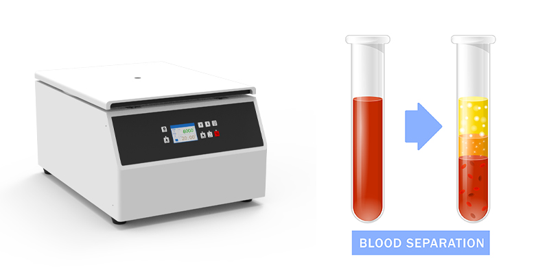 Separation of serum using a centrifuge