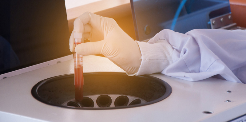 Separation of serum using a centrifuge-1