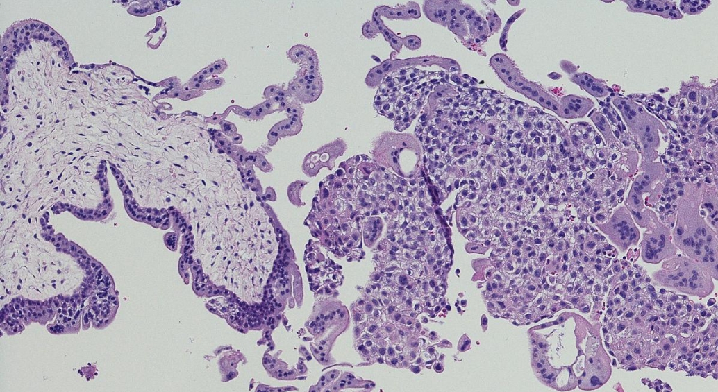 extravillous trophoblasts-1